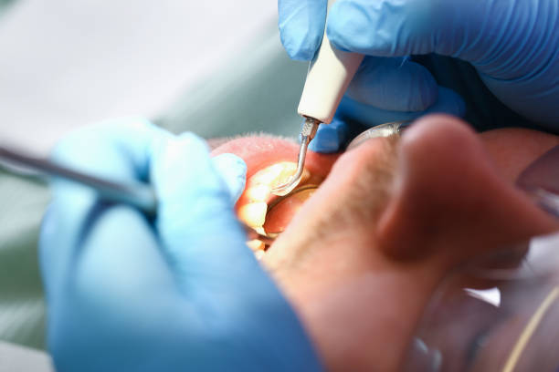 Best Holiday Emergency Dentist in Mills River, NC
