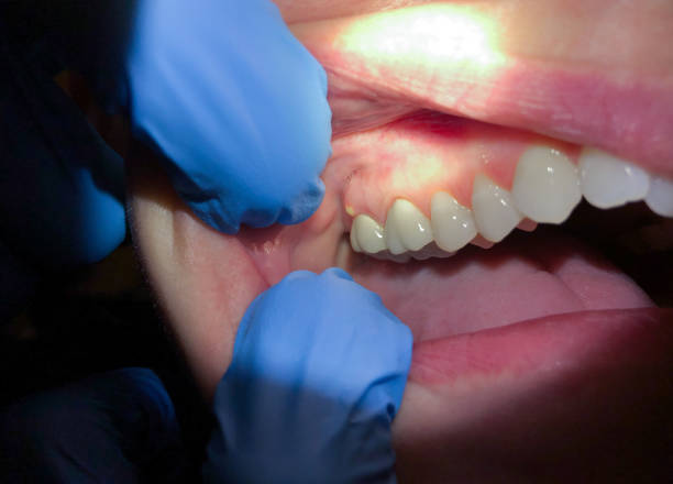 Best Mobile Emergency Dentist in Mills River, NC